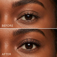 AuraVé™ Lift Love Kit